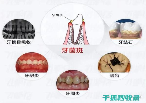 牙刷更换周期：你可能错过的隐藏风险 (牙刷更换周期多久)